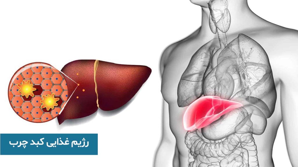 رژیم غذایی کبد چرب