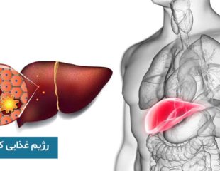 رژیم غذایی کبد چرب