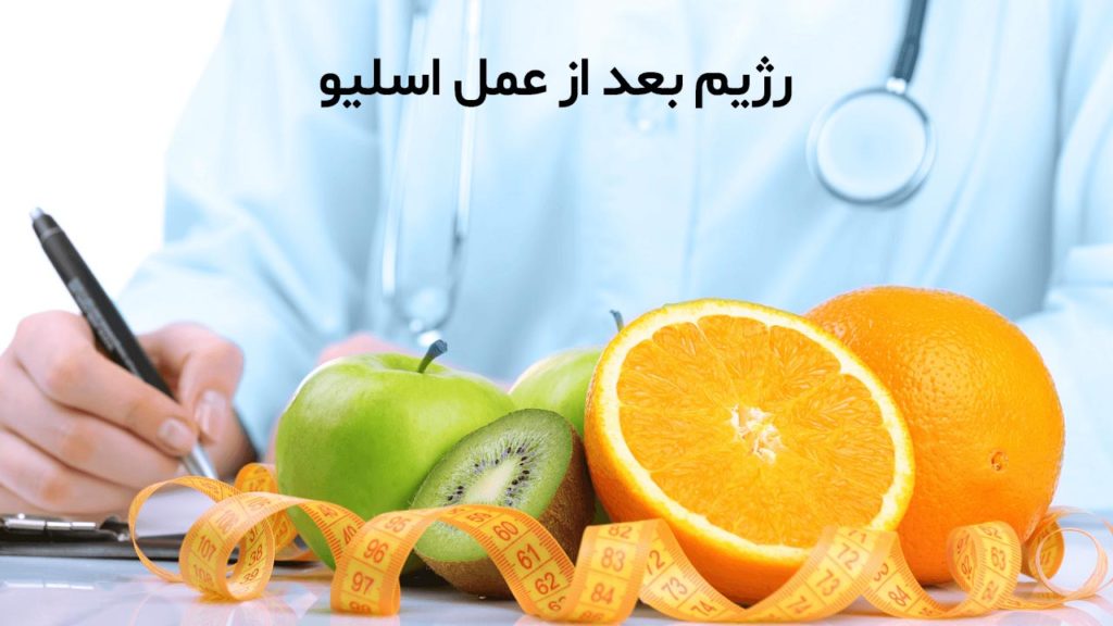 رژیم اسلیو