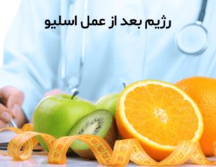 رژیم اسلیو