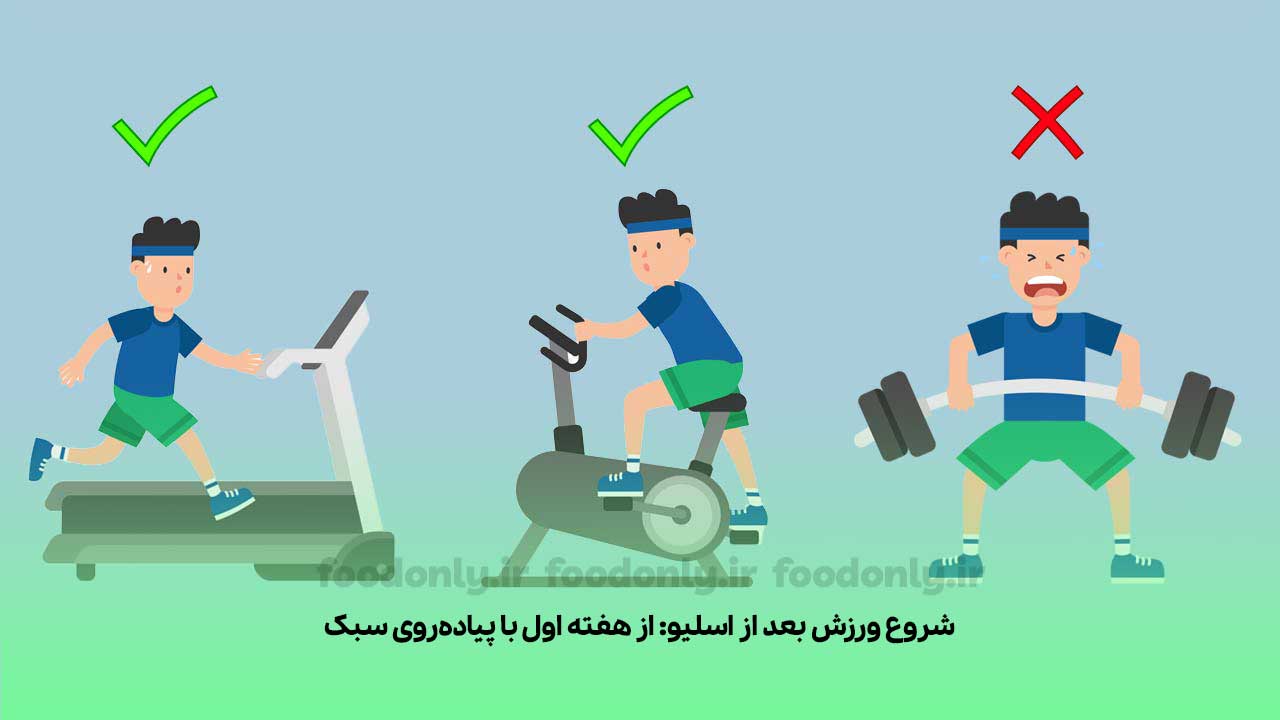 شروع ورزش بعد از جراحی اسلیو معده