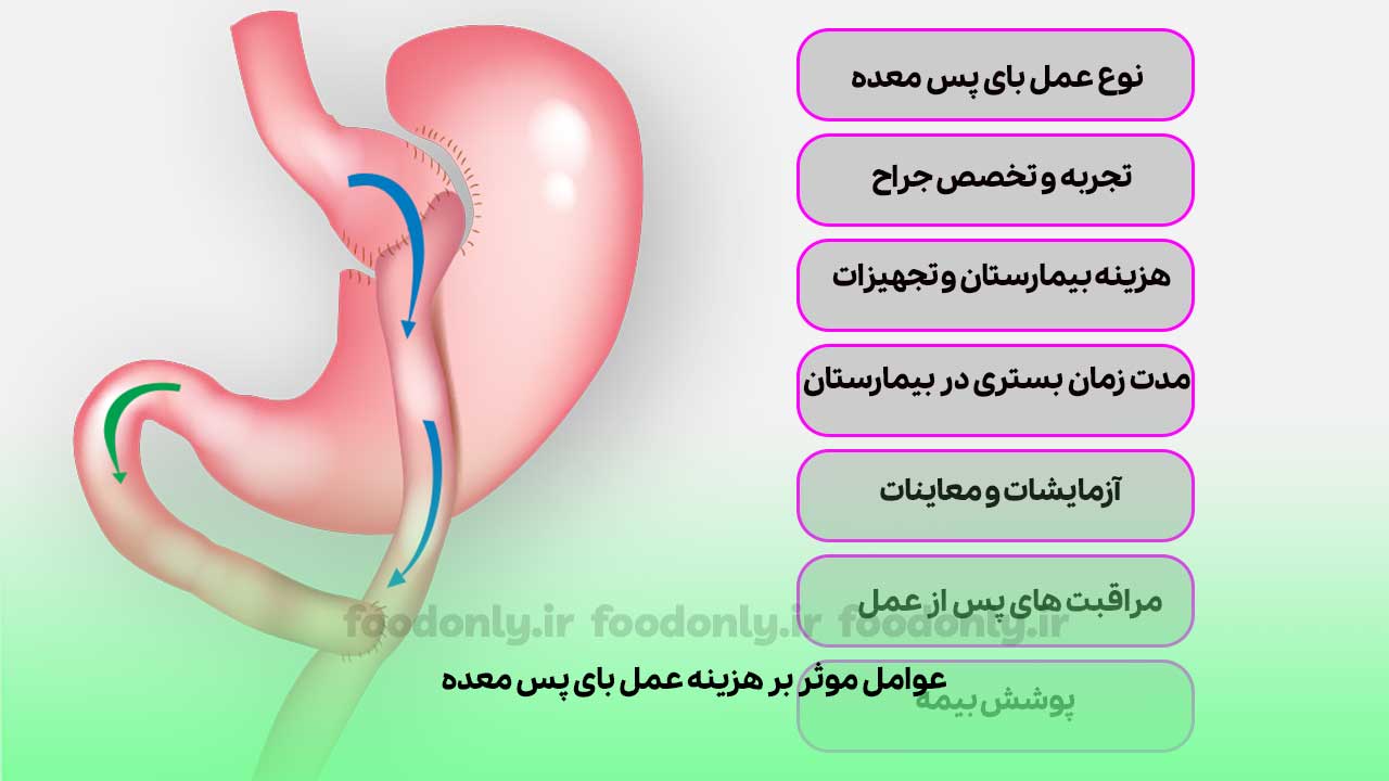 عوامل موثر بر هزینه عمل بای پس معده