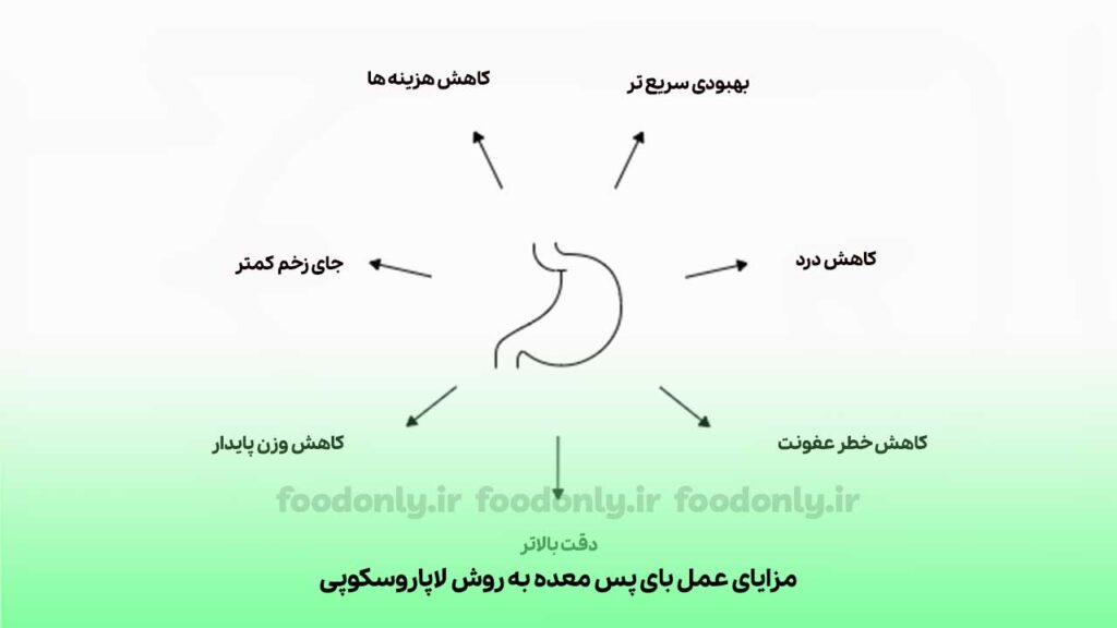 مزایای عمل بای پس معده به روش لاپاروسکوپی