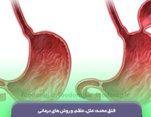فتق معده