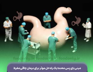 مینی بای پس معده