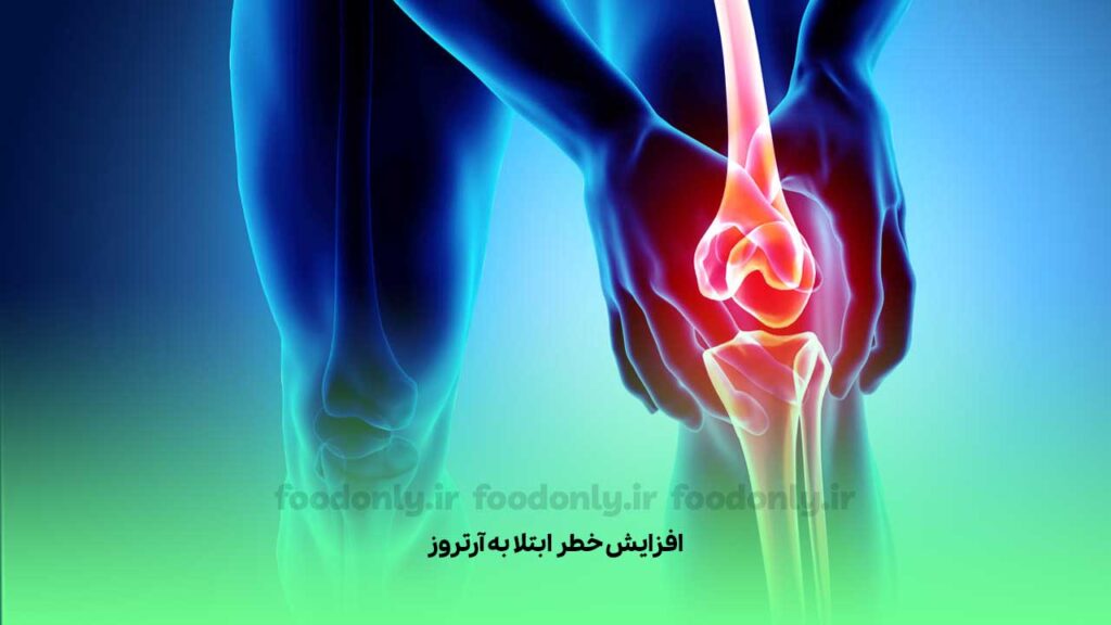 افزایش خطر ابتلا به آرتروز