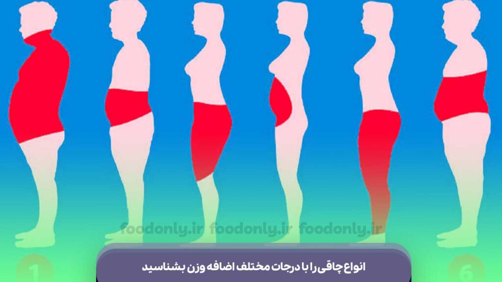 انواع چاقی