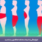 انواع چاقی