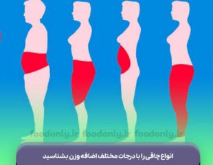 انواع چاقی