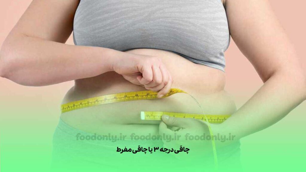 چاقی درجه 3 یا چاقی مفرط